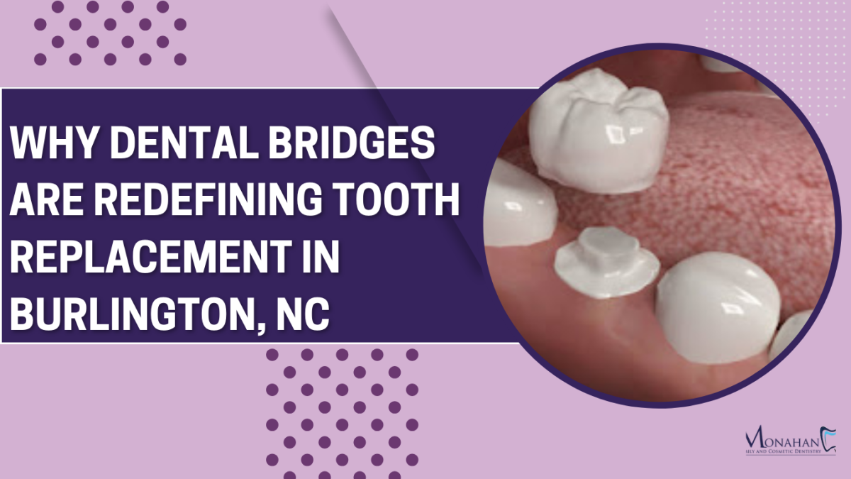 Why Dental Bridges are Redefining Tooth Replacement in Burlington, NC