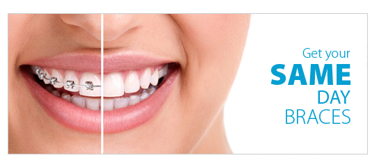 Clermont Practice, Modern Orthodontics, Shares Insights on Who Clear Aligners Work Best For