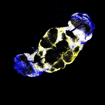 New research reveals how the brain turns experience into memory — with help from a tiny protein