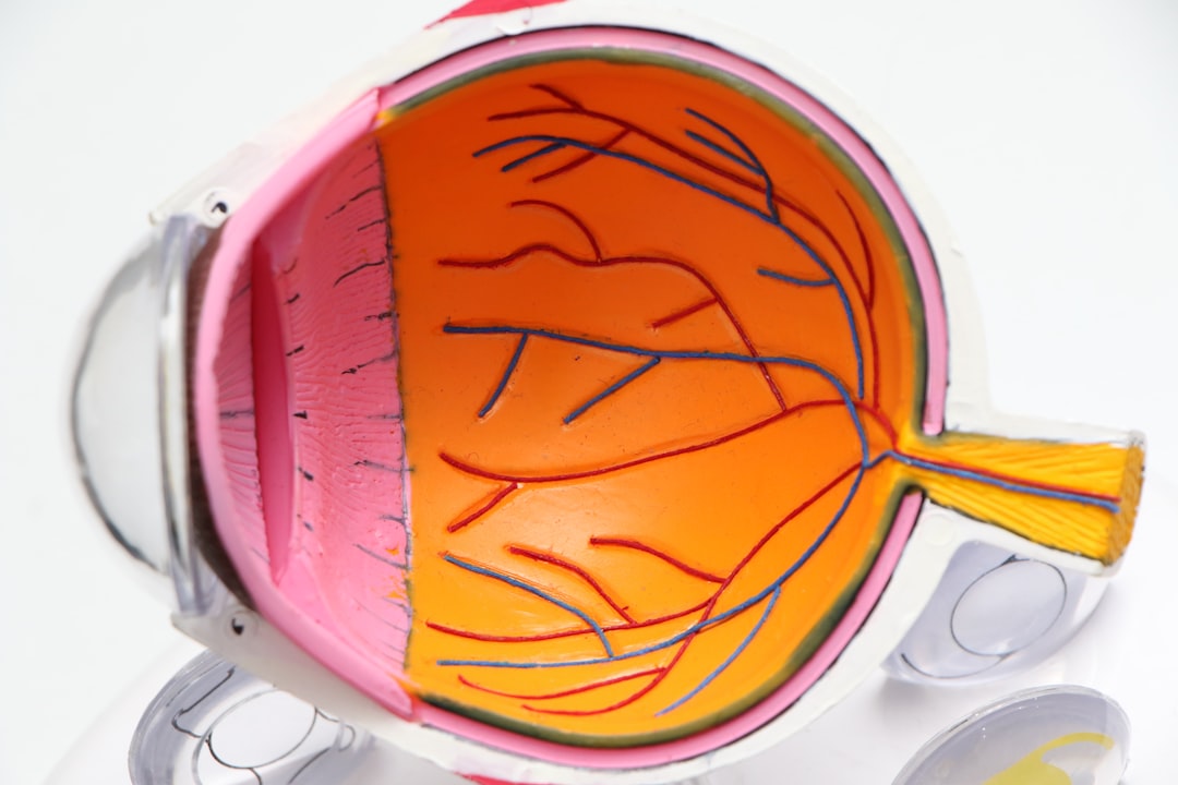 ‘Devastating’: Eye surgeon diagnosed with inflammatory eye condition and then cataracts feared losing sight and career