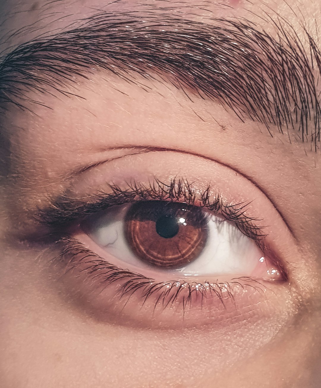Assessing Suboptimal Vision After Cataract Surgery: Why It Happens, and When We Enhance