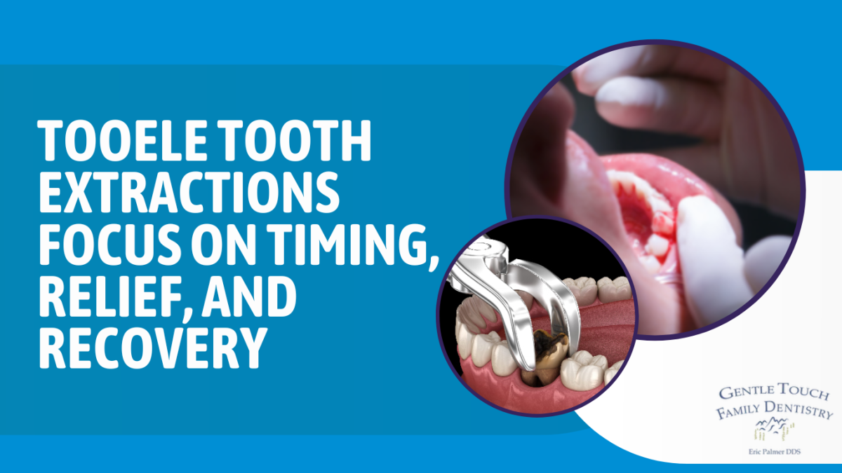 Tooele Tooth Extractions Focus on Timing, Relief, and Recovery